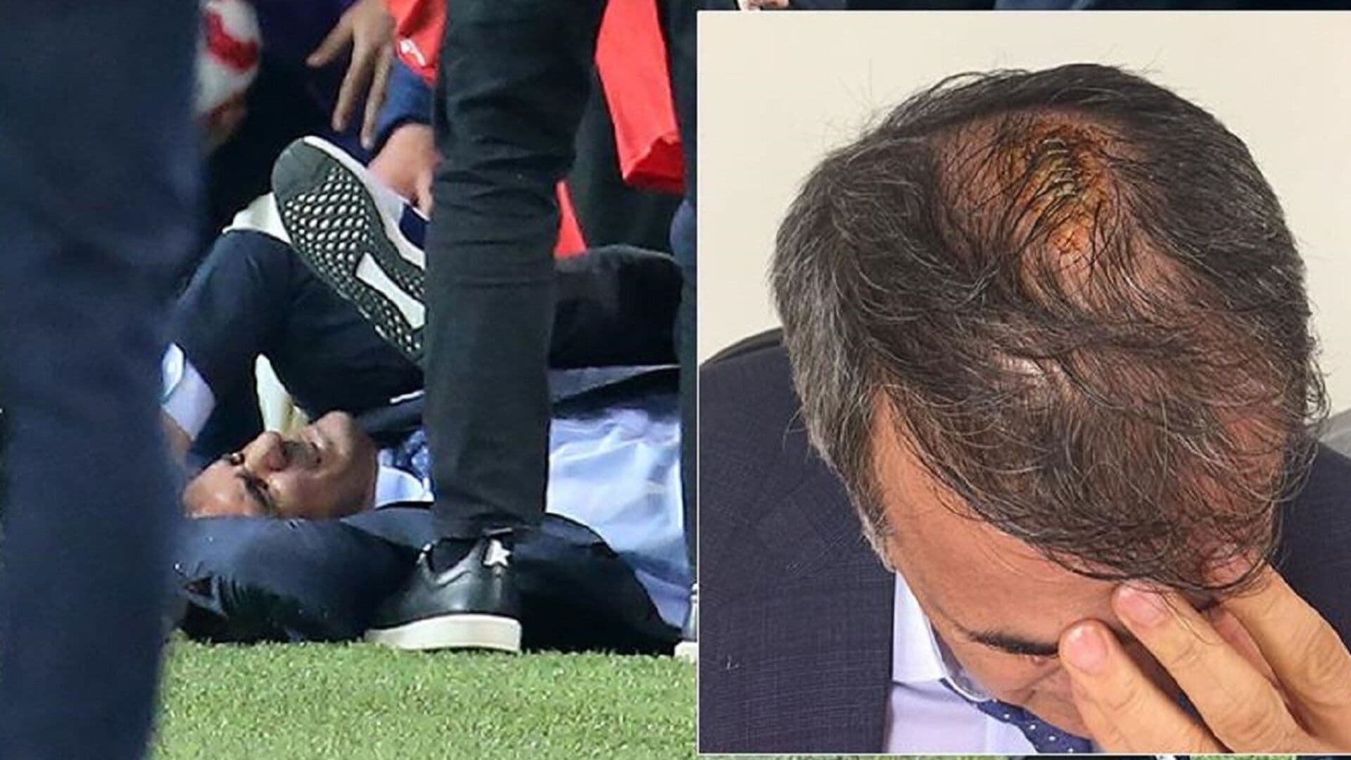 Beşiktaş Teknik Direktörü Şenol Güneş'in Fenerbahçe maçında başına aldığı darbe sonucu yerde kaldığı anlar.