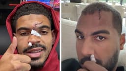 Morgan Gibbs-White ve Robert Sanchez'in yüzünün son durumu korkuttu