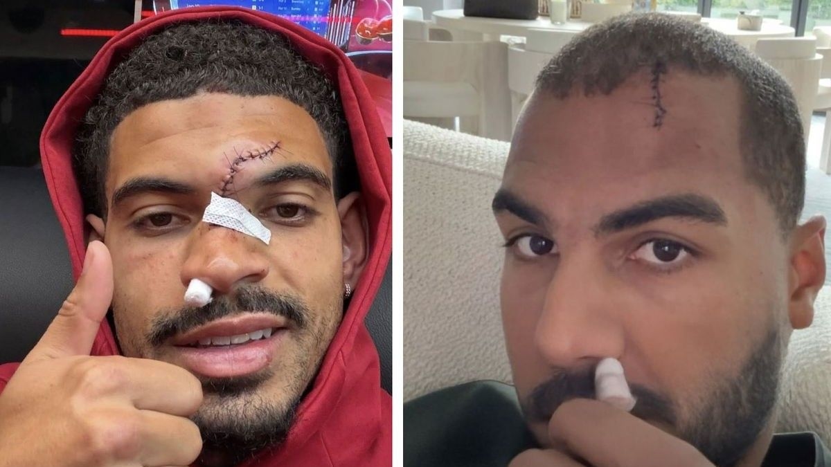 Morgan Gibbs-White ve Robert Sanchez'in yüzünün son durumu korkuttu